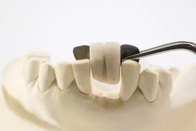 Dentures in Bondi Junction — Full, Partial and Implant-Retained Options