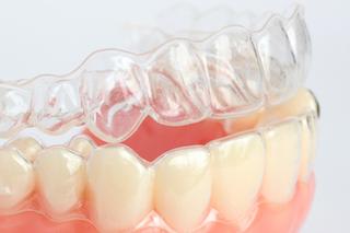 invisalign aligners sit on a mold | invisalign bondi junction