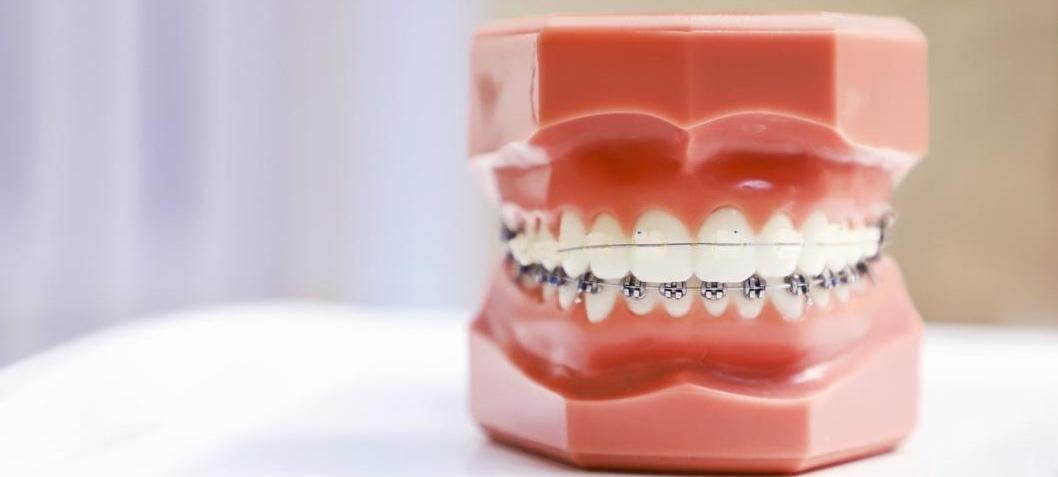 orthodontics bondi nsw