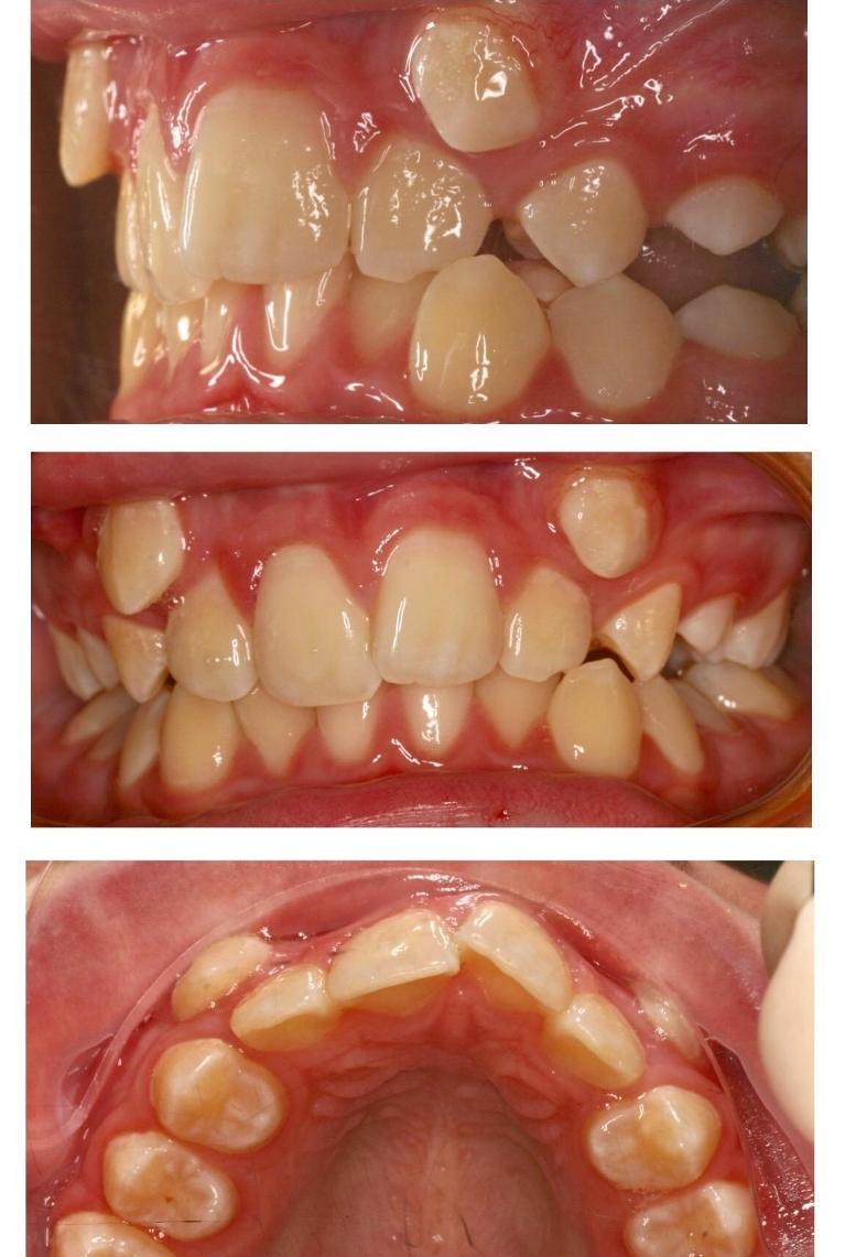 Before-and-After-Orthodontics-Before-Image